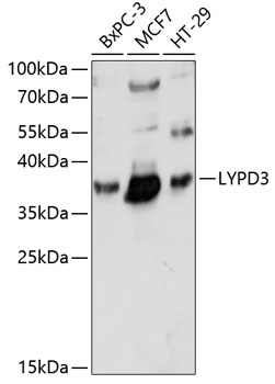 LYPD3 Rabbit Polyclonal Antibody