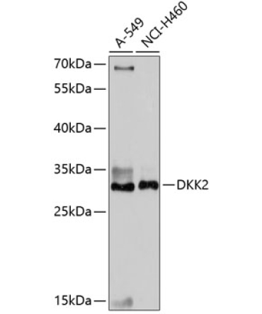 DKK2 Rabbit Polyclonal Antibody
