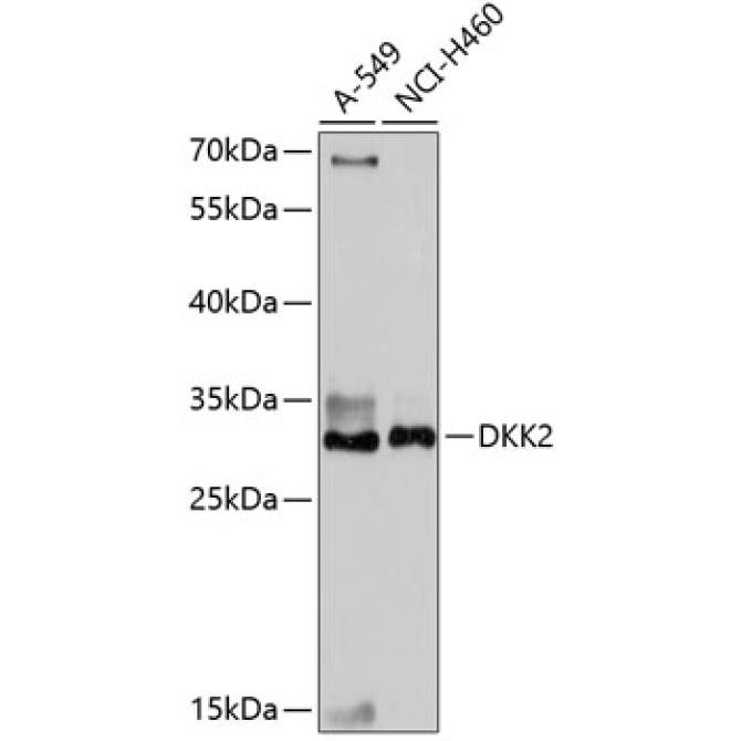 DKK2 Rabbit Polyclonal Antibody