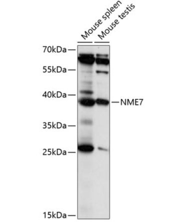 NME7 Rabbit Polyclonal Antibody
