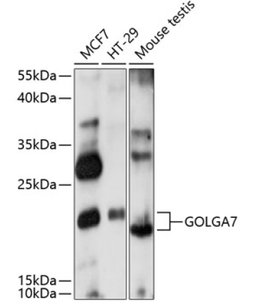 GOLGA7 Rabbit Polyclonal Antibody