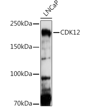 CDK12 Rabbit Polyclonal Antibody