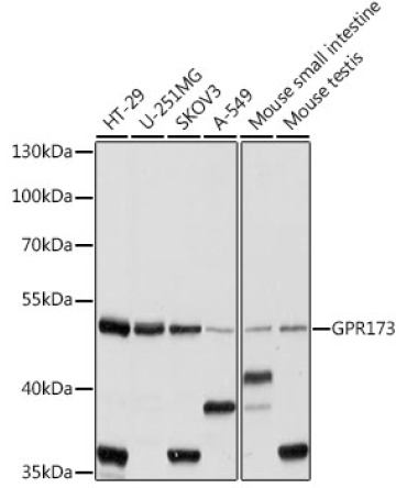 GPR173 Rabbit Polyclonal Antibody