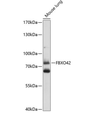 FBXO42 Rabbit Polyclonal Antibody