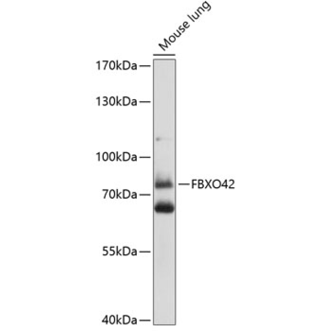 FBXO42 Rabbit Polyclonal Antibody