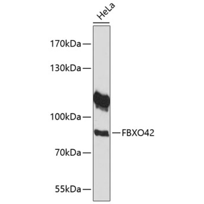 FBXO42 Rabbit Polyclonal Antibody