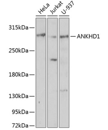ANKHD1 Rabbit Polyclonal Antibody