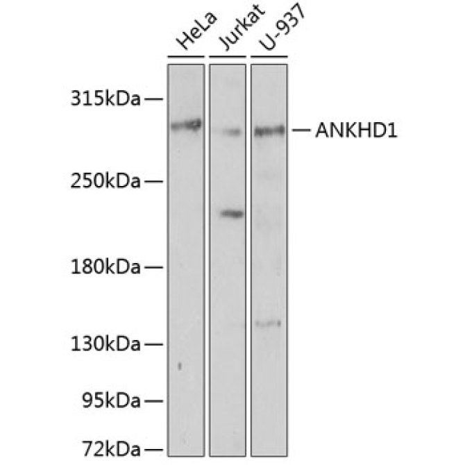 ANKHD1 Rabbit Polyclonal Antibody