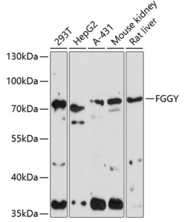 FGGY Rabbit Polyclonal Antibody