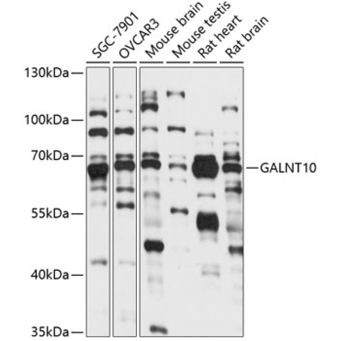 GALNT10 Rabbit Polyclonal Antibody