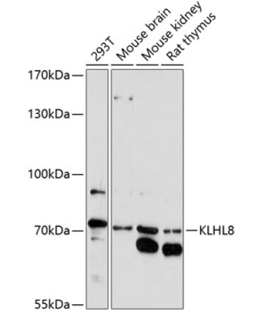 KLHL8 Rabbit Polyclonal Antibody