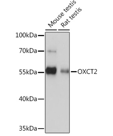 OXCT2 Rabbit Polyclonal Antibody