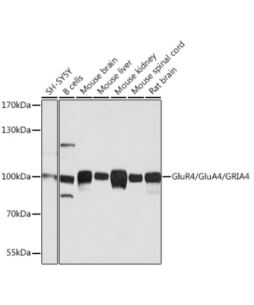 GluR4/GluA4/GRIA4 Rabbit Polyclonal Antibody
