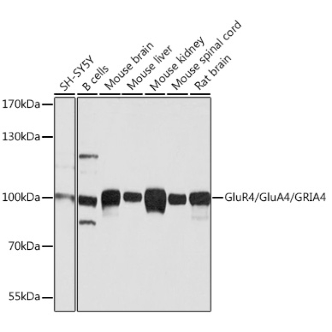 GluR4/GluA4/GRIA4 Rabbit Polyclonal Antibody