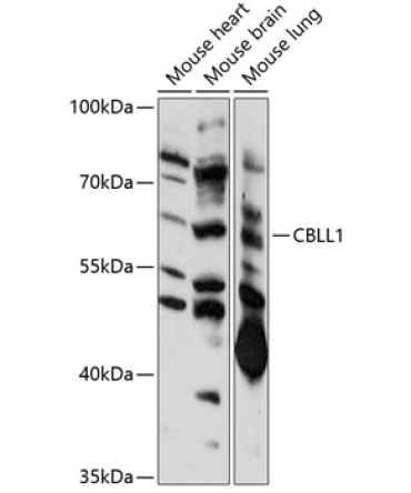 CBLL1 Rabbit Polyclonal Antibody
