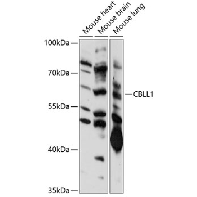 CBLL1 Rabbit Polyclonal Antibody