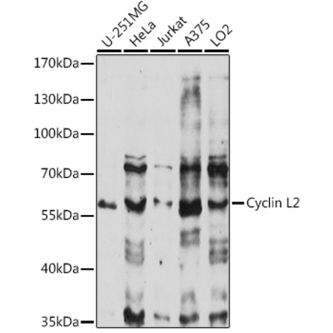 Cyclin L2 Rabbit Polyclonal Antibody