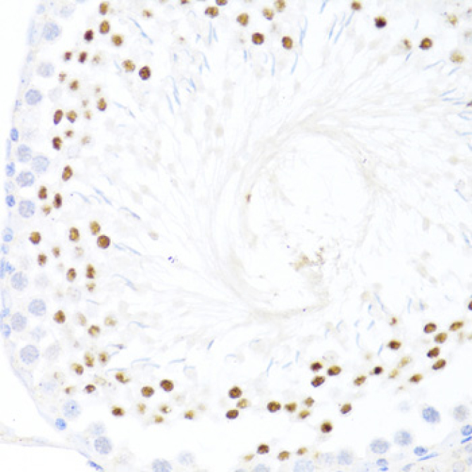 DDX59 Rabbit Polyclonal Antibody