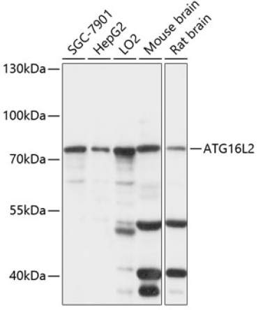 ATG16L2 Rabbit Polyclonal Antibody