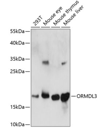 ORMDL3 Rabbit Polyclonal Antibody