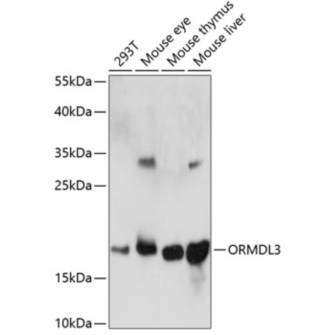 ORMDL3 Rabbit Polyclonal Antibody