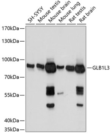 GLB1L3 Rabbit Polyclonal Antibody