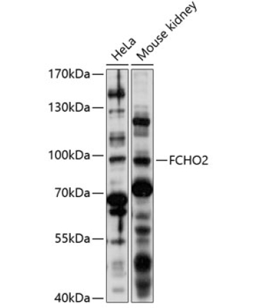 FCHO2 Rabbit Polyclonal Antibody
