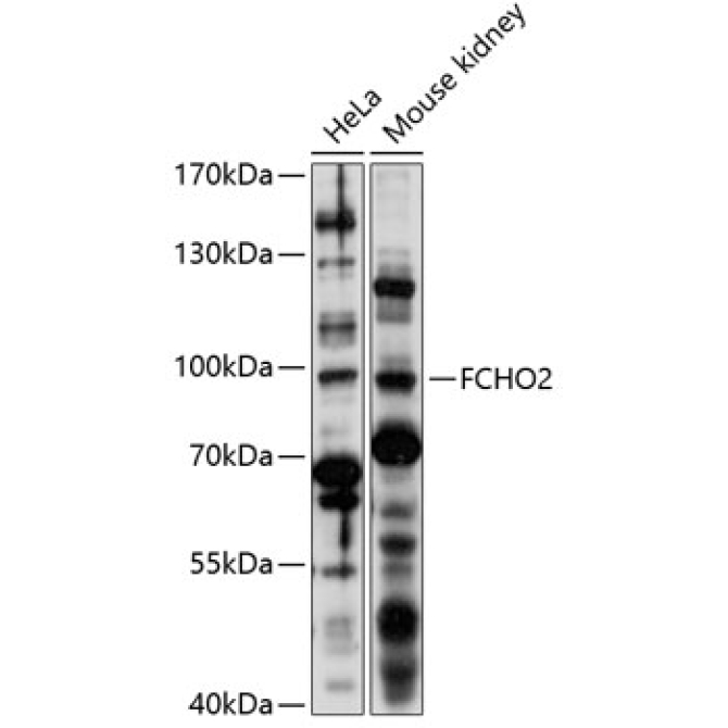 FCHO2 Rabbit Polyclonal Antibody