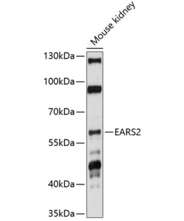 EARS2 Rabbit Polyclonal Antibody