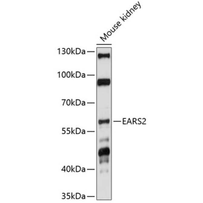 EARS2 Rabbit Polyclonal Antibody