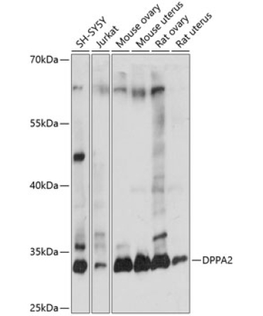 DPPA2 Rabbit Polyclonal Antibody