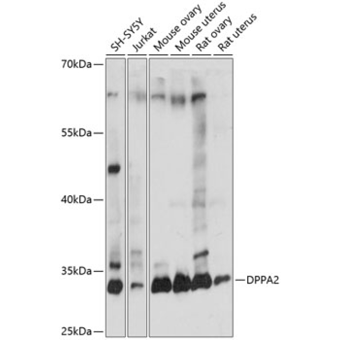 DPPA2 Rabbit Polyclonal Antibody