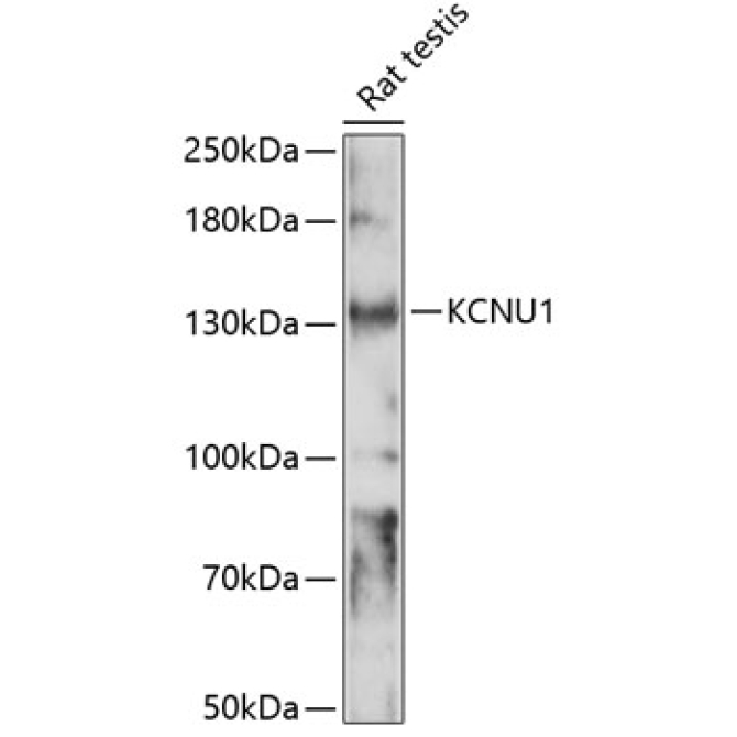 KCNU1 Rabbit Polyclonal Antibody