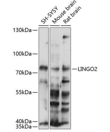 LINGO2 Rabbit Polyclonal Antibody