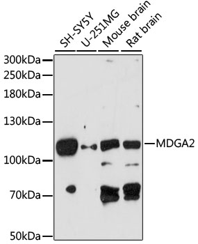 MDGA2 Rabbit Polyclonal Antibody