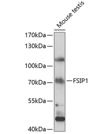 FSIP1 Rabbit Polyclonal Antibody