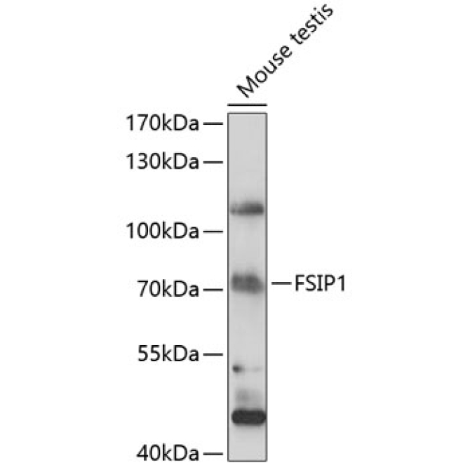 FSIP1 Rabbit Polyclonal Antibody