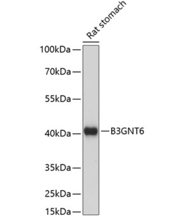B3GNT6 Rabbit Polyclonal Antibody