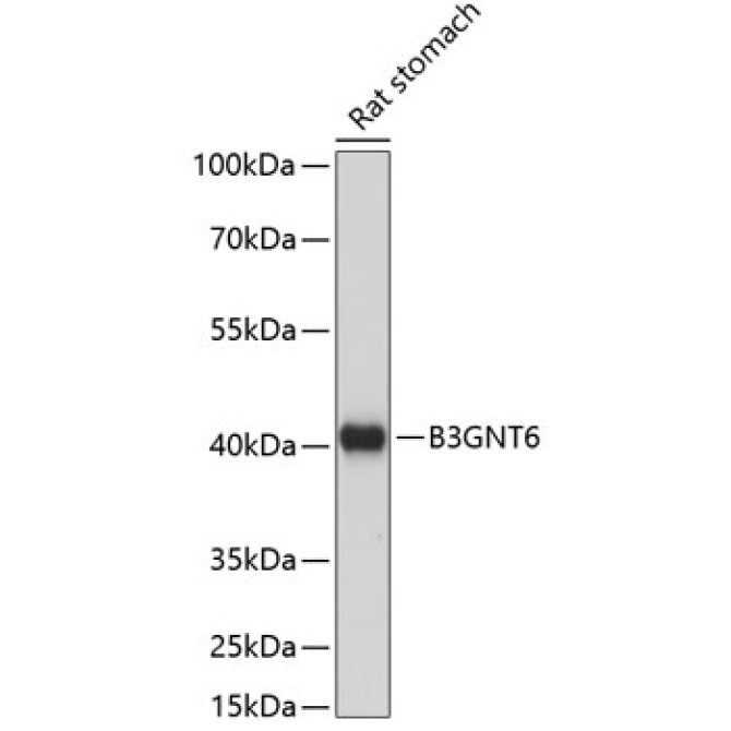 B3GNT6 Rabbit Polyclonal Antibody