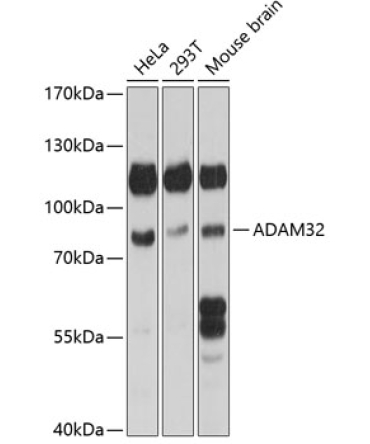 ADAM32 Rabbit Polyclonal Antibody