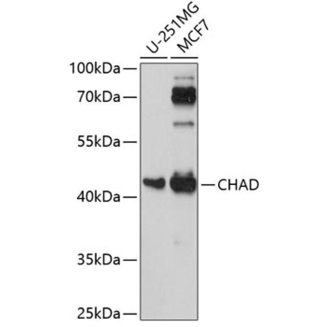 CHAD Rabbit Polyclonal Antibody