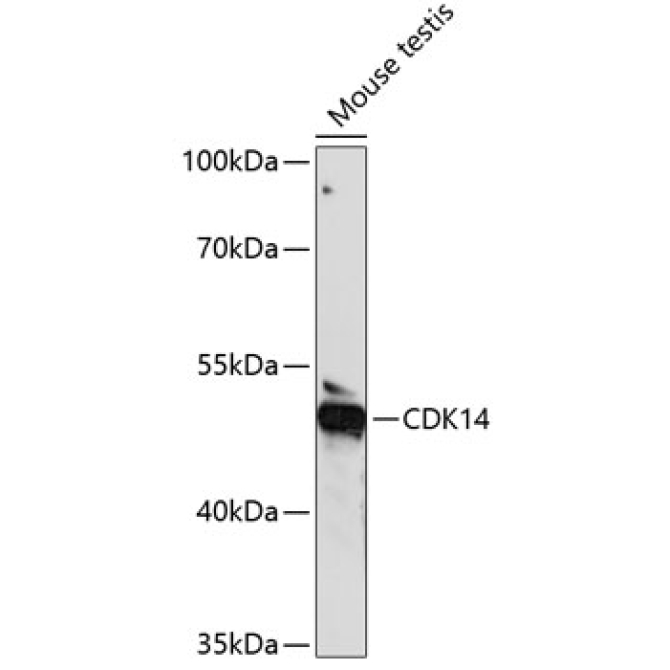 CDK14 Rabbit Polyclonal Antibody
