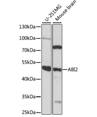 ABI2 Rabbit Polyclonal Antibody