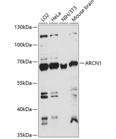 ARCN1 Rabbit Polyclonal Antibody