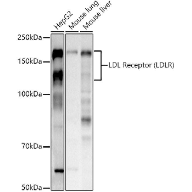 LDL Receptor (LDLR) Rabbit Polyclonal Antibody