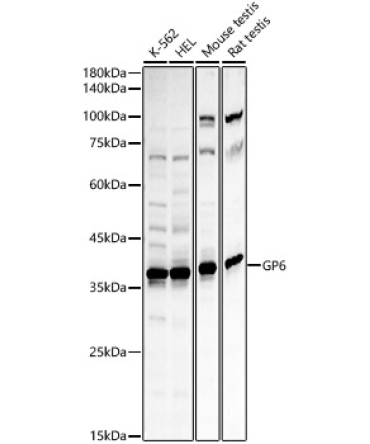 GP6 Rabbit Polyclonal Antibody