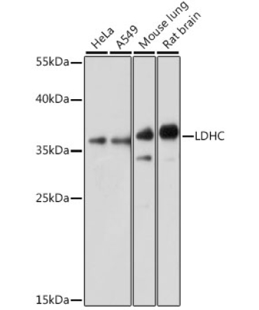 LDHC Rabbit Polyclonal Antibody
