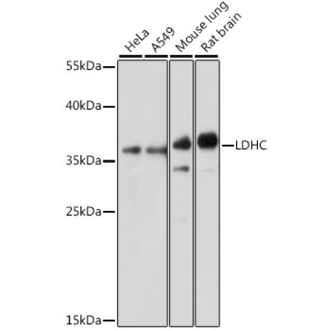 LDHC Rabbit Polyclonal Antibody