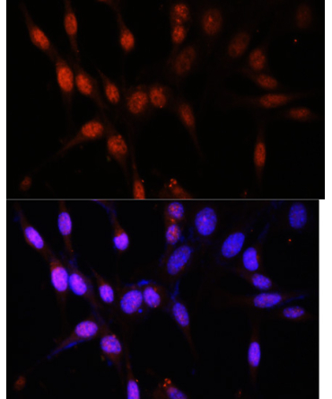 KAT6A Rabbit Polyclonal Antibody