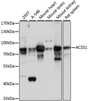 ACSS1 Rabbit Polyclonal Antibody